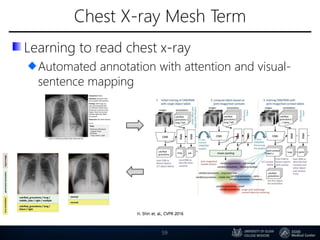 Chest X-ray Mesh Term
59
Learning to read chest x-ray
Automated annotation with attention and visual-
sentence mapping
 
