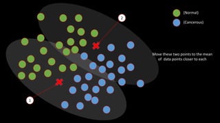 (Normal)
(Cancerous)
Move these two points to the mean
of data points closer to each
1
2
 