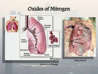 Oxides of Nitrogen
Irritation of lungs
lung cancer
 