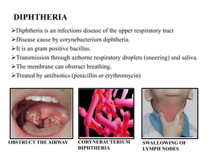 Diphtheria is an infections disease of the upper respiratory tract
Disease cause by corynebacterium diphtheria.
It is an gram positive bacillus.
Transmission through airborne respiratory droplets (sneezing) and saliva.
The membrane can obstruct breathing.
Treated by antibiotics (penicillin or erythromycin)
DIPHTHERIA
OBSTRUCT THE AIRWAY CORYNEBACTERIUM
DIPHTHERIA
SWALLOWING OF
LYMPH NODES
 