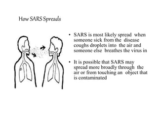 How SARS Spreads
• SARS is most likely spread when
someone sick from the disease
coughs droplets into the air and
someone else breathes the virus in
• It is possible that SARS may
spread more broadly through the
air or from touching an object that
is contaminated
 