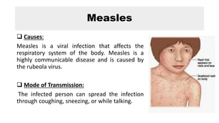 Measles
 Causes:
Measles is a viral infection that affects the
respiratory system of the body. Measles is a
highly communicable disease and is caused by
the rubeola virus.
 Mode of Transmission:
The infected person can spread the infection
through coughing, sneezing, or while talking.
 