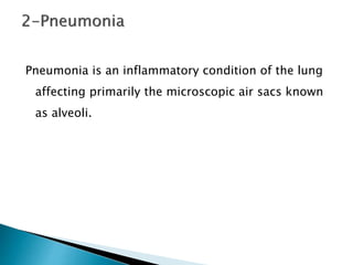 Pneumonia is an inflammatory condition of the lung
affecting primarily the microscopic air sacs known
as alveoli.
 