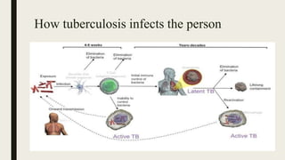 How tuberculosis infects the person
 
