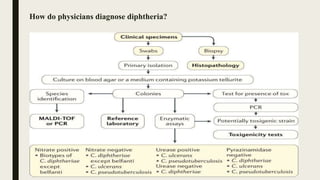 How do physicians diagnose diphtheria?
 