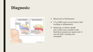 Diagnosis:
 Blood tests to find bacteria
 CT or MRI scans of your head to find
swelling or inflammation
 Spinal tap, in which a health
care worker uses a needle to take
fluid from around your spinal cord. It
can tell what’s causing your
meningitis.
 