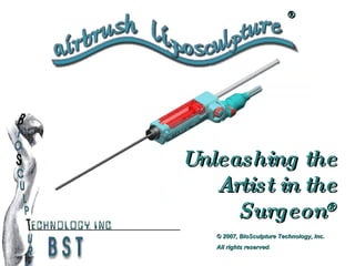®




Unleashing the
   Artist in the
     Surgeon®
   © 2007, BioSculpture Technology, Inc.
   All rights reserved.
              reserved
 