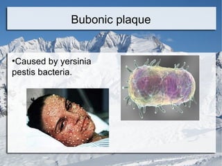 Air borne diseases. | ODP