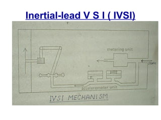 Inertial-lead V S I ( IVSI)
 