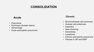 CONSOLIDATION
Acute
• Pneumonia
• Pulmonary alveolar edema
• Hemorrhage
• Acute eosinophilic pneumonia
Chronic
• Bronchoalveolar cell carcinoma
• Alveolar cell proteinosis
• Aspiration
• Near-drowning
• Sarcoidosis
• Lymphoma
• Chronic eosinophilic pneumonia
• Fibrosis in UIP and NSIP
 