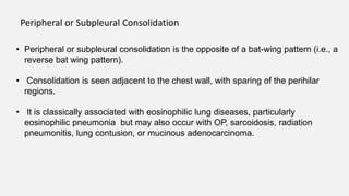 • Peripheral or subpleural consolidation is the opposite of a bat-wing pattern (i.e., a
reverse bat wing pattern).
• Consolidation is seen adjacent to the chest wall, with sparing of the perihilar
regions.
• It is classically associated with eosinophilic lung diseases, particularly
eosinophilic pneumonia but may also occur with OP, sarcoidosis, radiation
pneumonitis, lung contusion, or mucinous adenocarcinoma.
Peripheral or Subpleural Consolidation
 