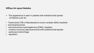 Diffuse Air-space Nodules
 This appearance is seen in patients with endobronchial spread
of infection such as :
• Tuberculosis (TB) or Mycobacterium avium complex (MAC) bacterial
• bronchopneumonia
• viral pneumonia (cytomegalovirus [CMV], measles)
• invasive mucinous adenocarcinoma with endobronchial spread
• pulmonary hemorrhage
• aspiration.
 