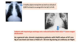 Air travel & Respiratory diseases | PPTX