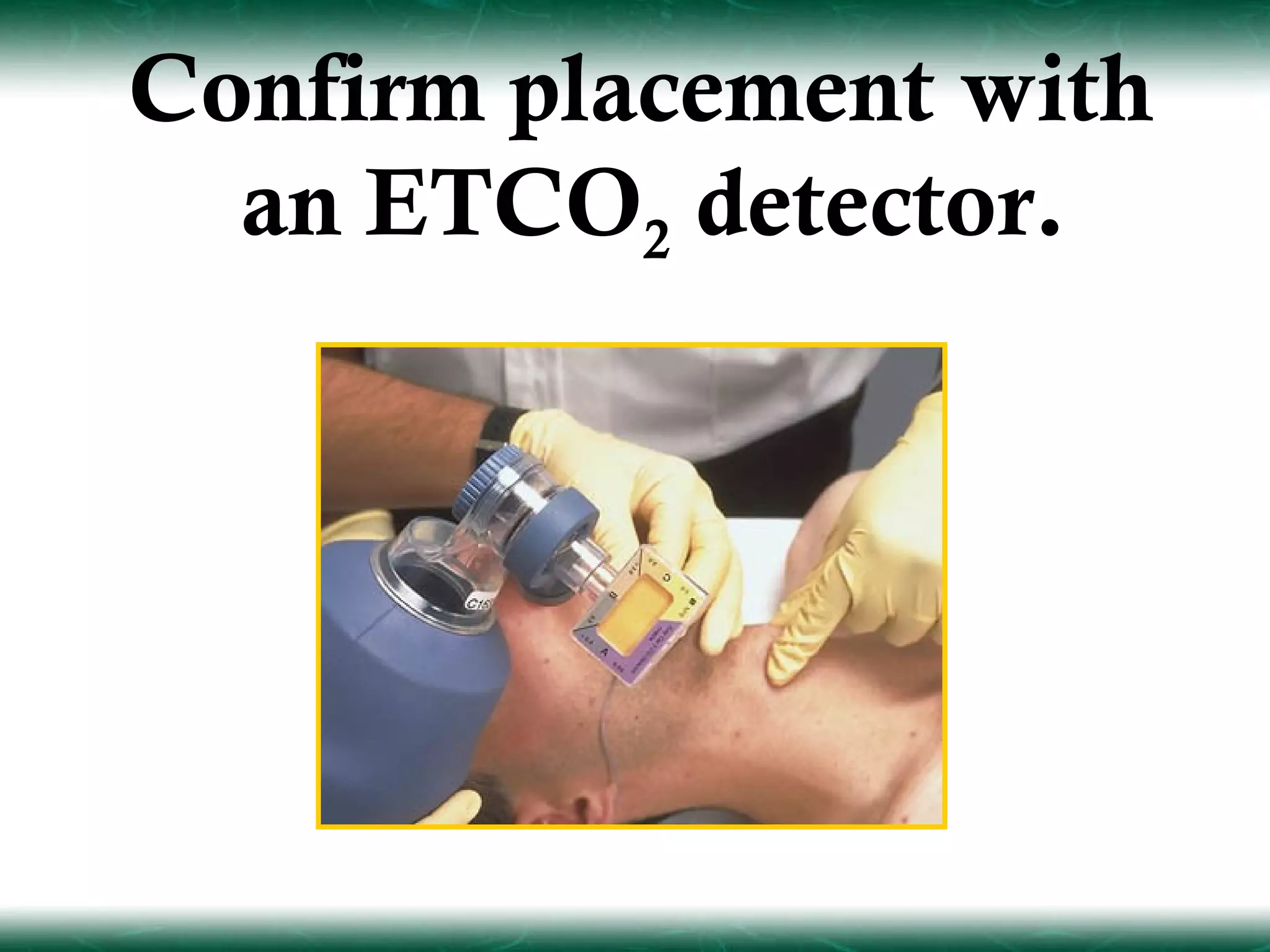 Confirm placement with
  an ETCO2 detector.
 