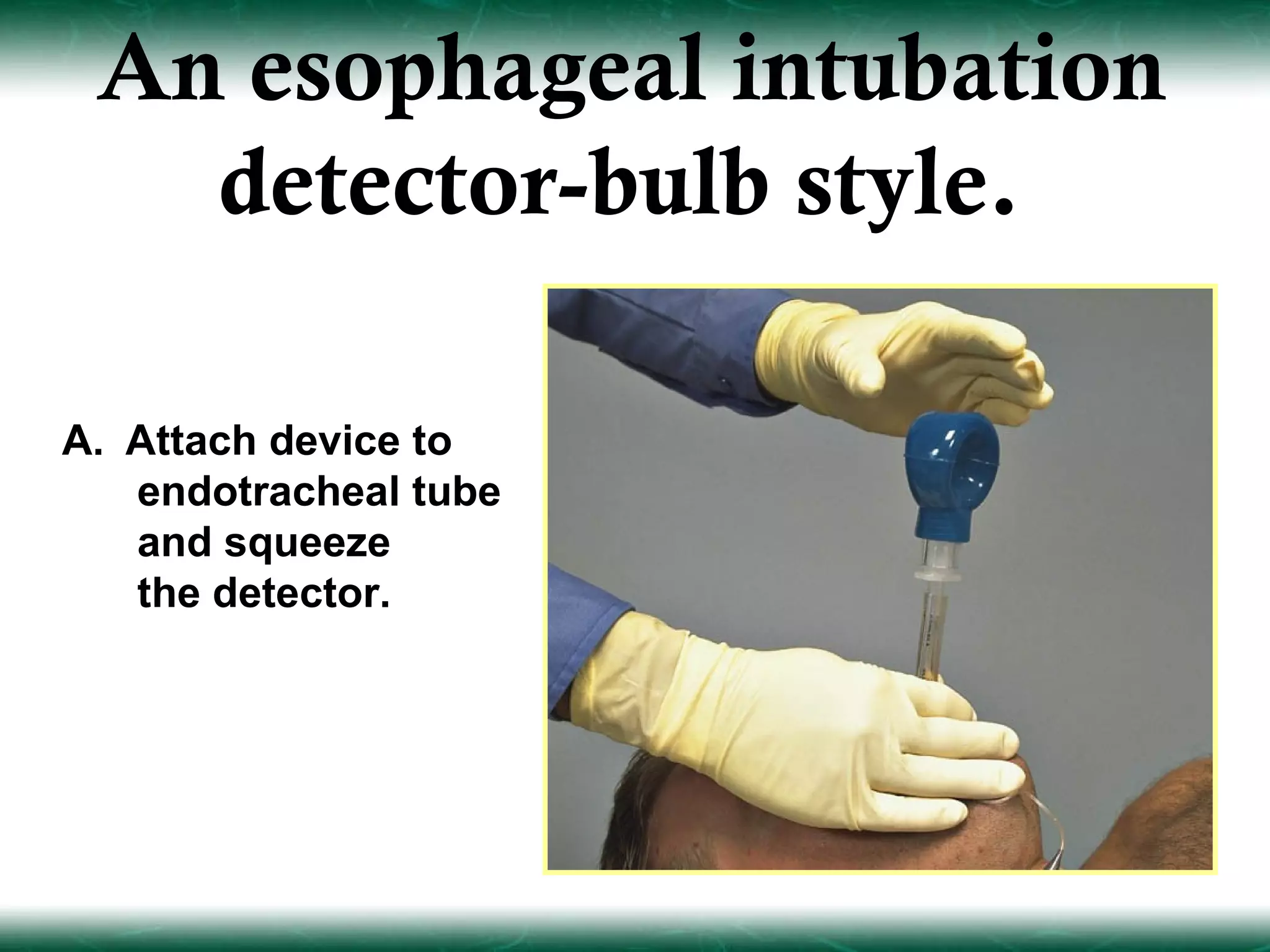 An esophageal intubation
   detector-bulb style.

A. Attach device to
   endotracheal tube
   and squeeze
   the detector.
 