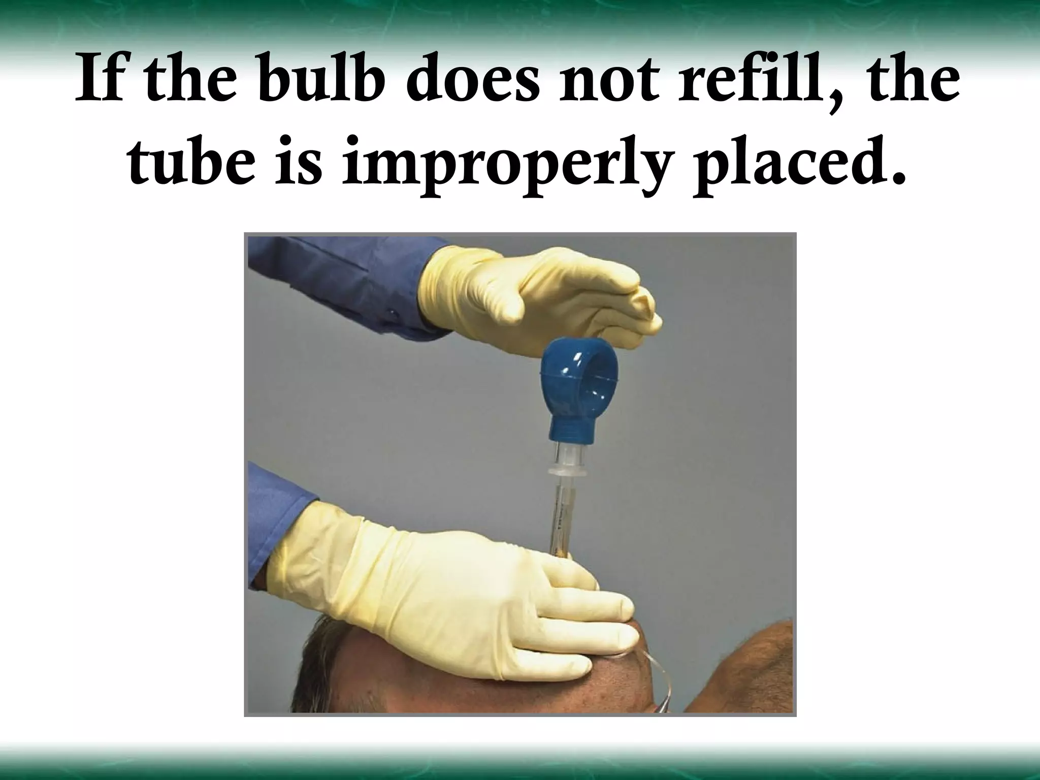 If the bulb does not refill, the
  tube is improperly placed.
 