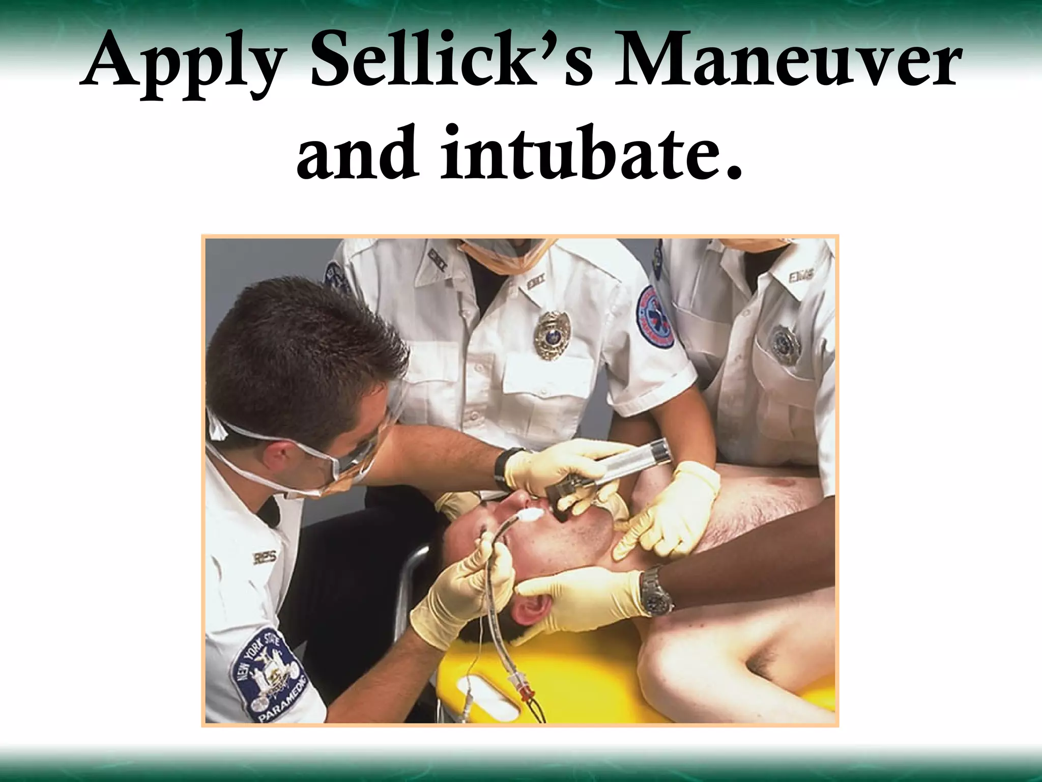 Apply Sellick’s Maneuver
     and intubate.
 