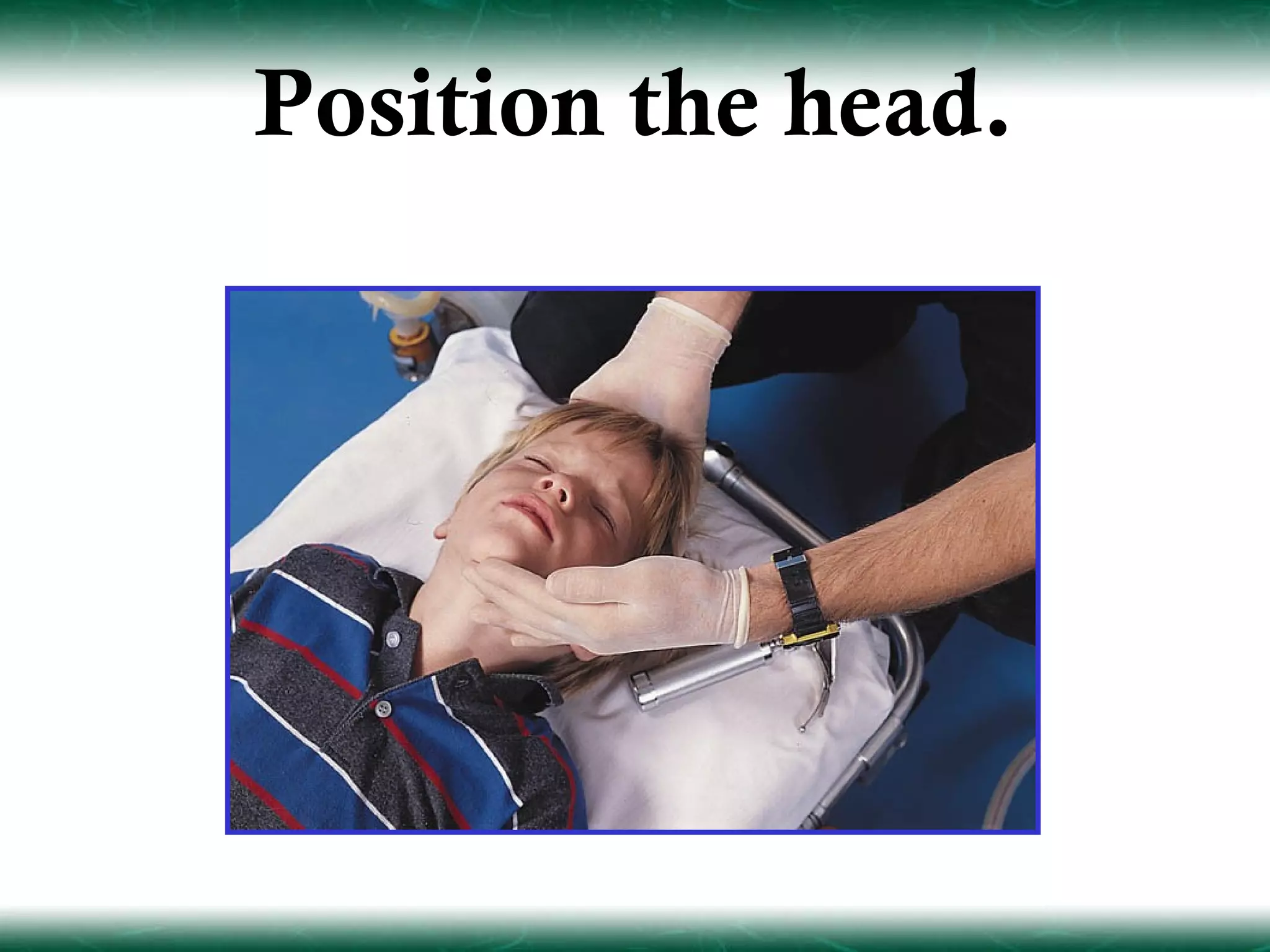 Position the head.
 