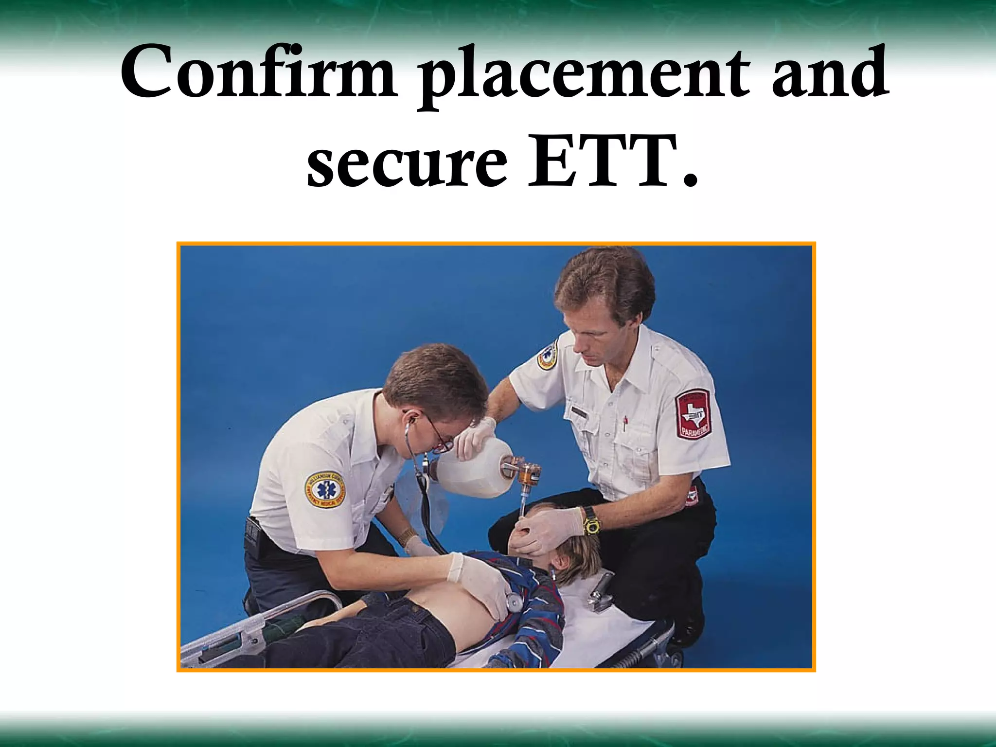 Confirm placement and
     secure ETT.
 