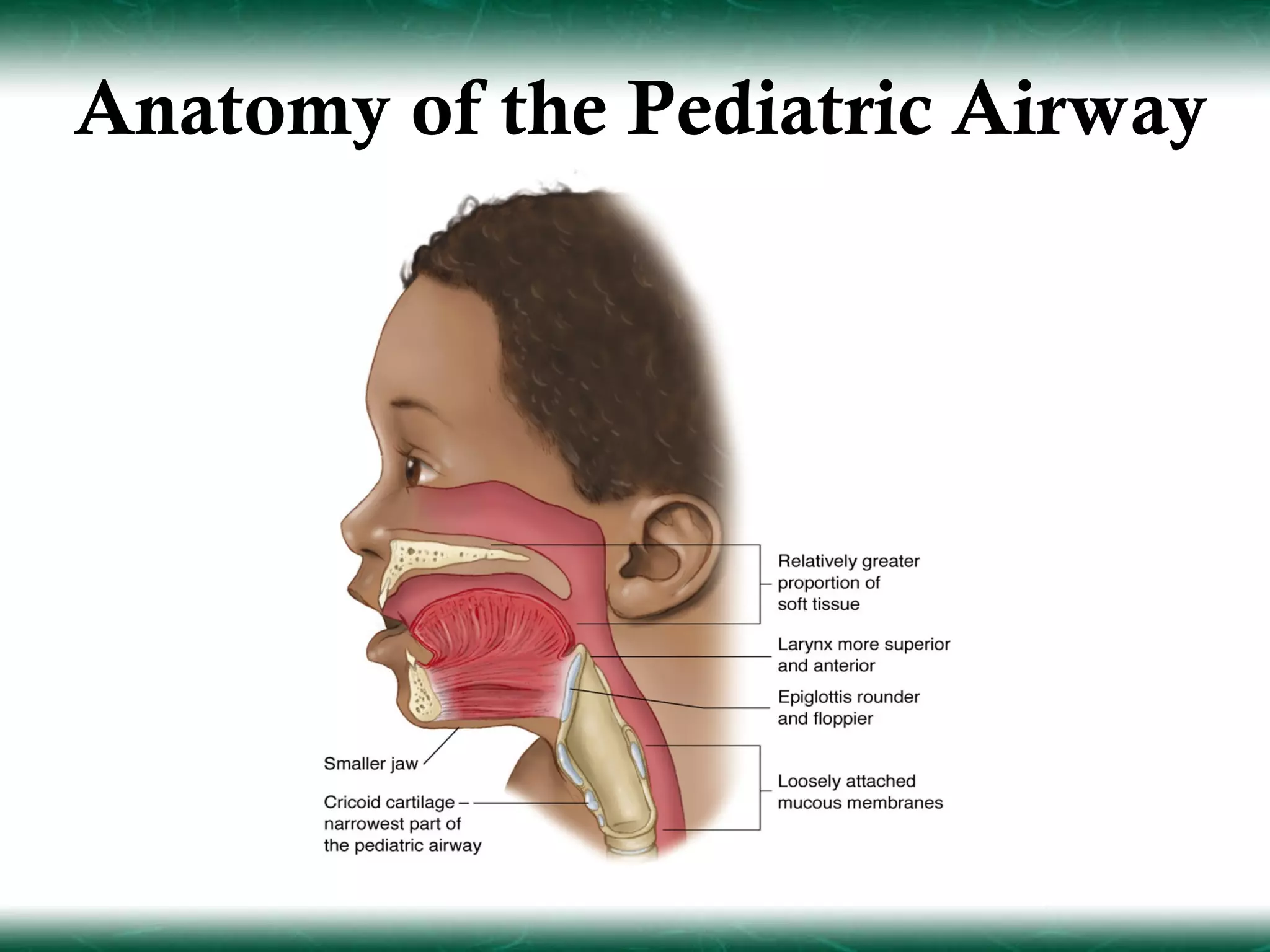 Anatomy of the Pediatric Airway
 
