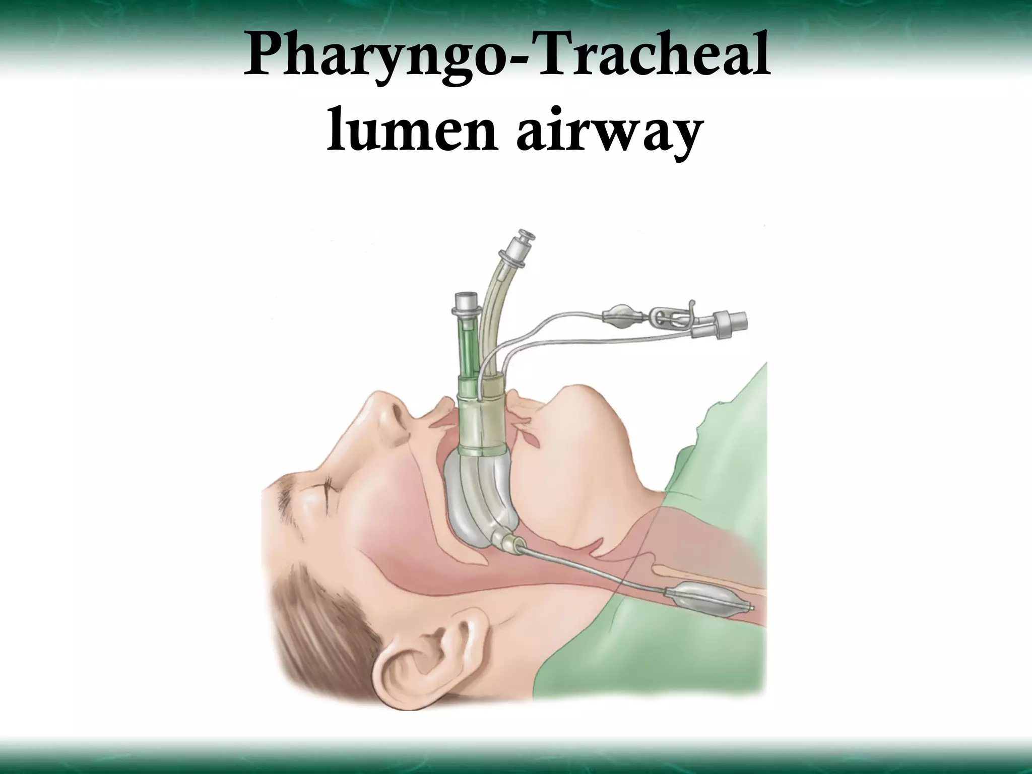 Pharyngo-Tracheal
  lumen airway
 