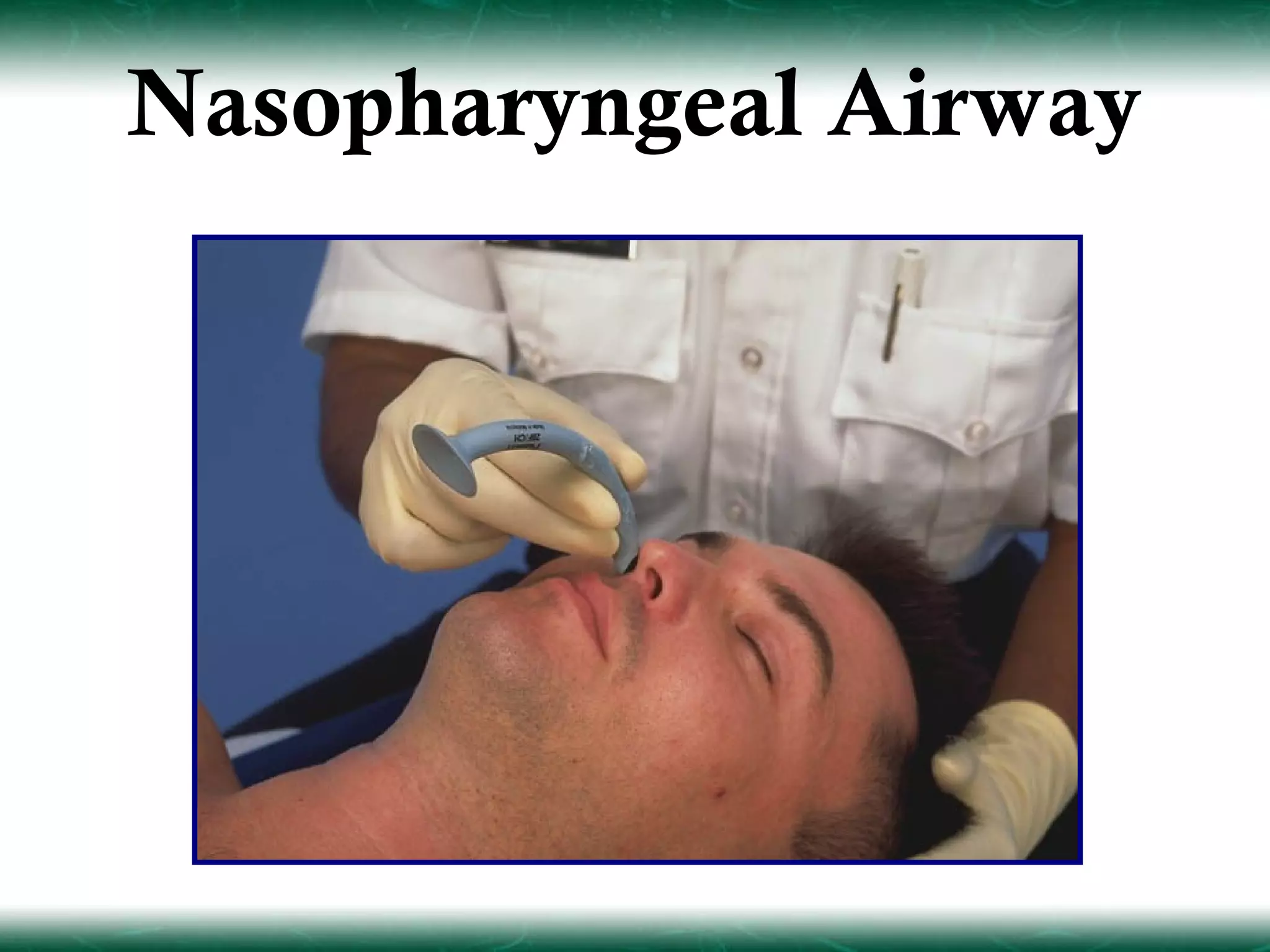 Nasopharyngeal Airway
 