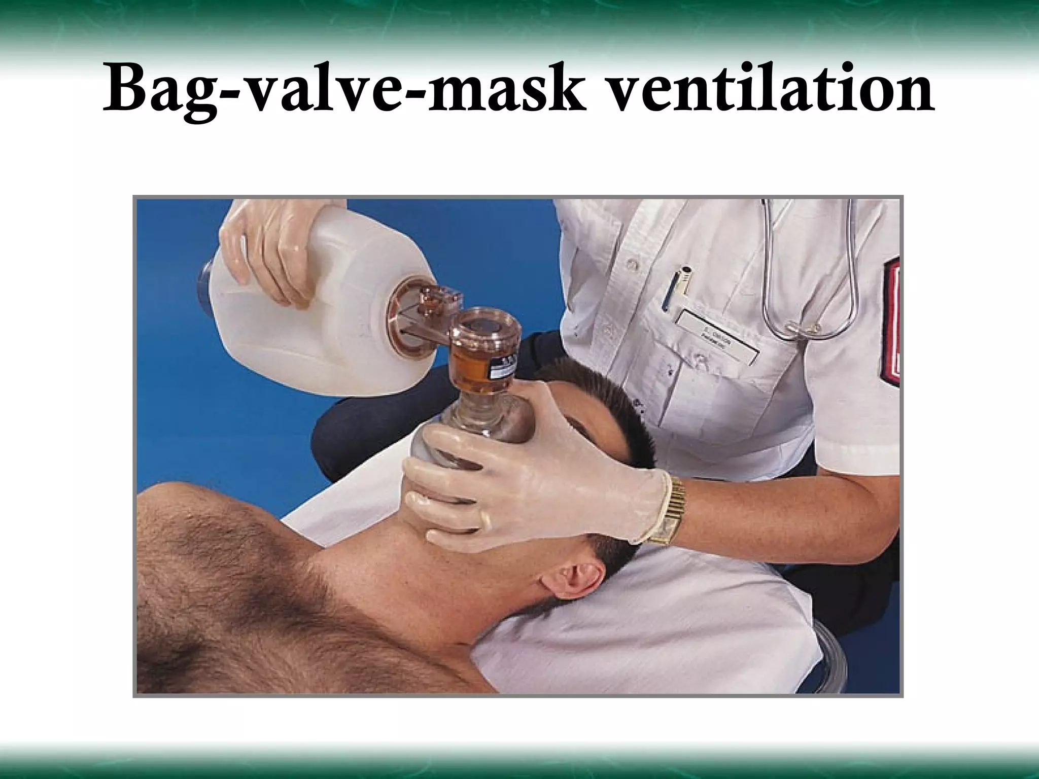 Bag-valve-mask ventilation
 