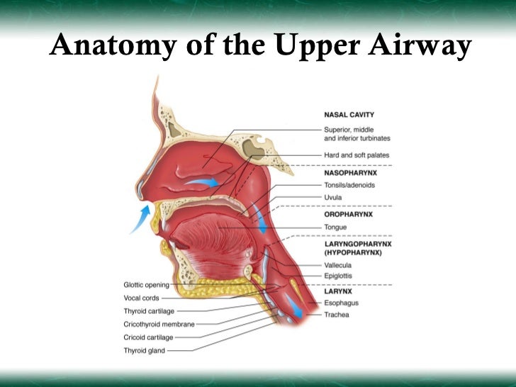 Airway