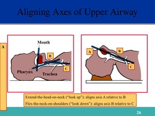 Airway introduction and management in icu.pptx