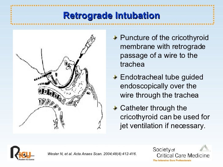 Airway Management
