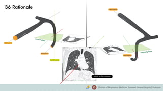 Default, no flip or rotation
B6 Rationale
 