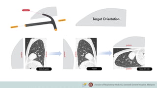 Default sagittal Flipped Rotate 90o CCW
posterior
posterior
posterior
posterior
posterior
posterior
 