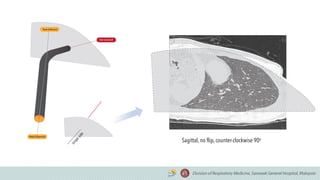 Sagittal, no flip, counter-clockwise 90o
 