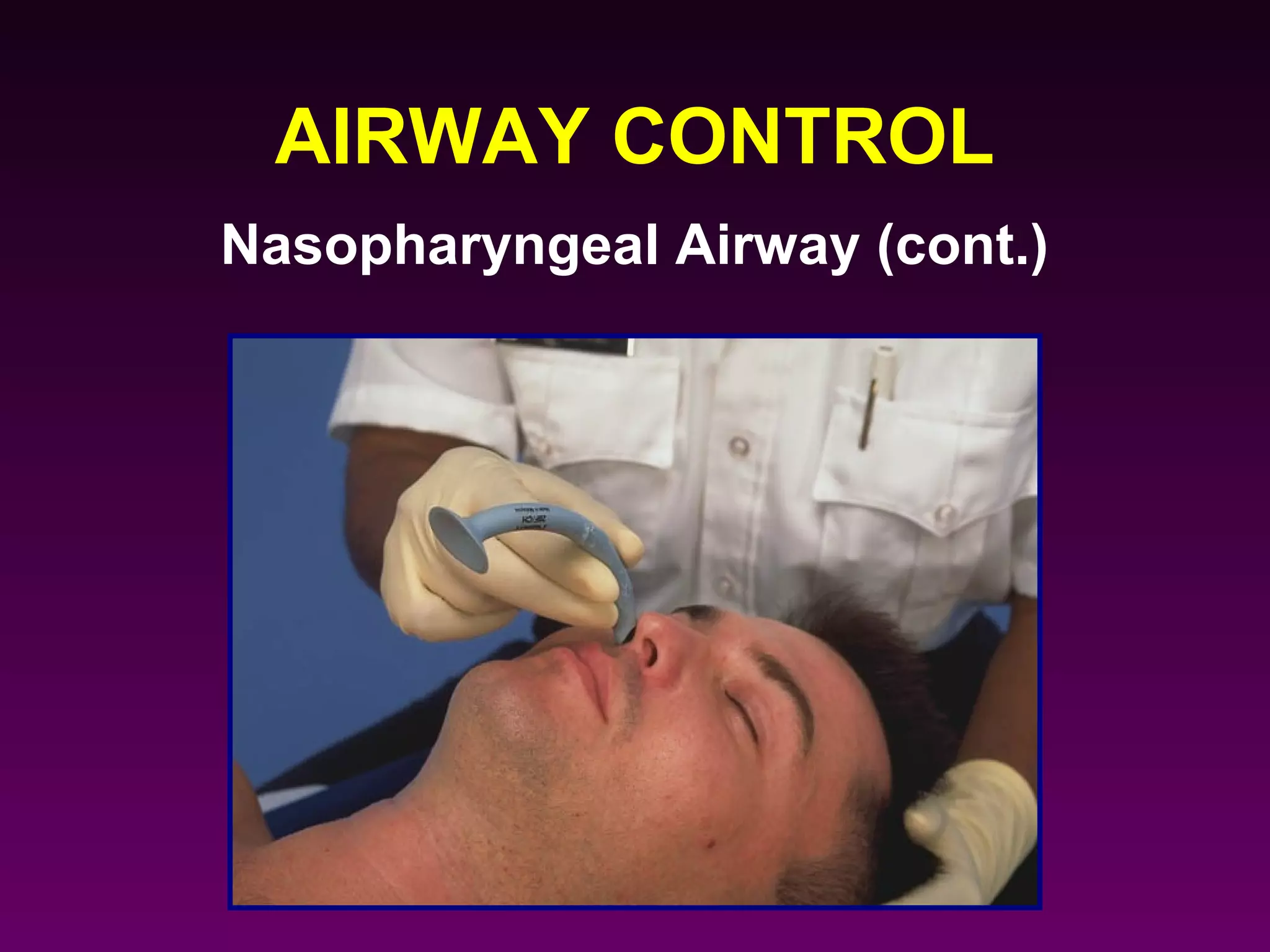 AIRWAY CONTROL
Nasopharyngeal Airway (cont.)
 