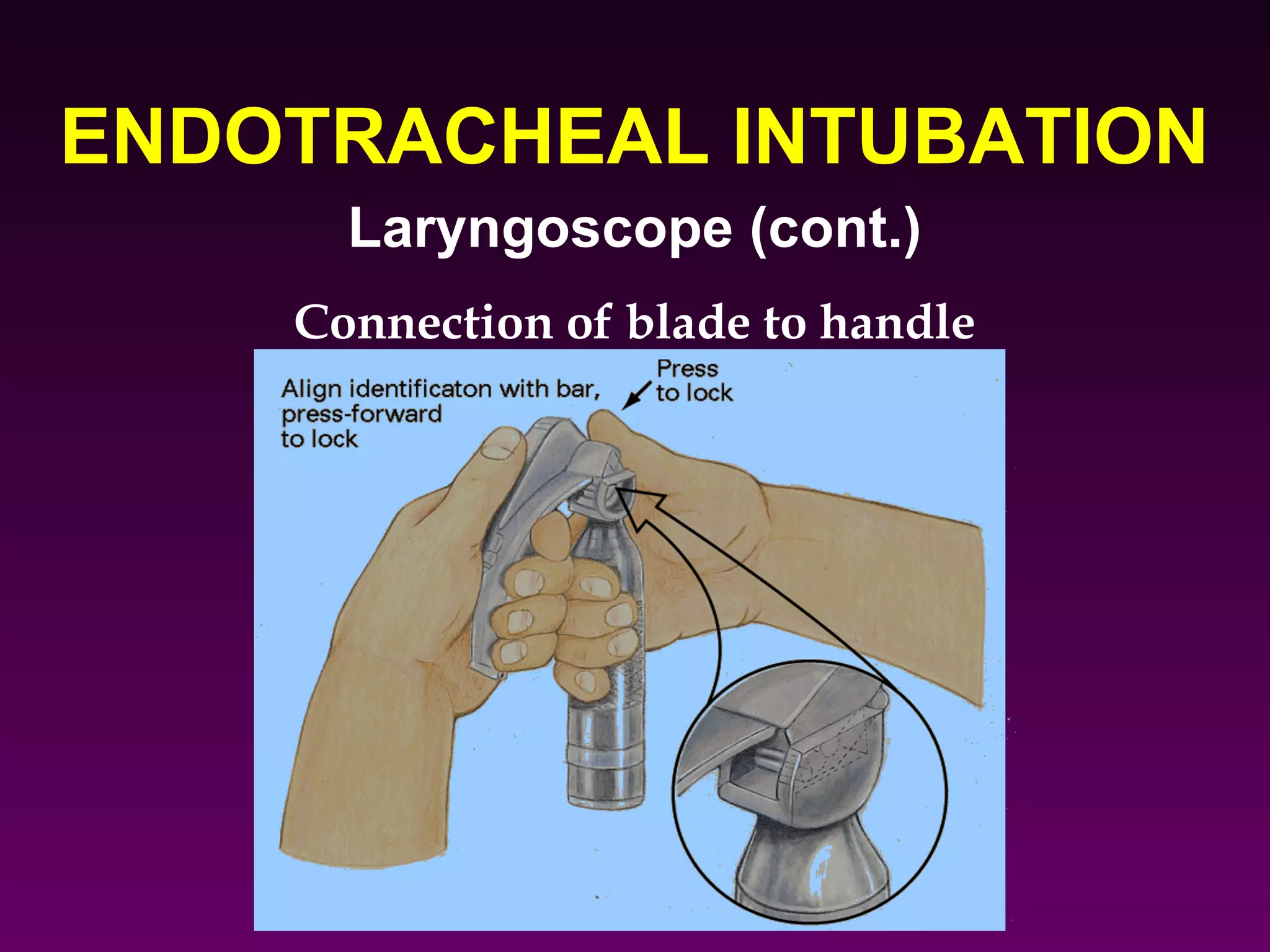 ENDOTRACHEAL INTUBATION
      Laryngoscope (cont.)
    Connection of blade to handle
 