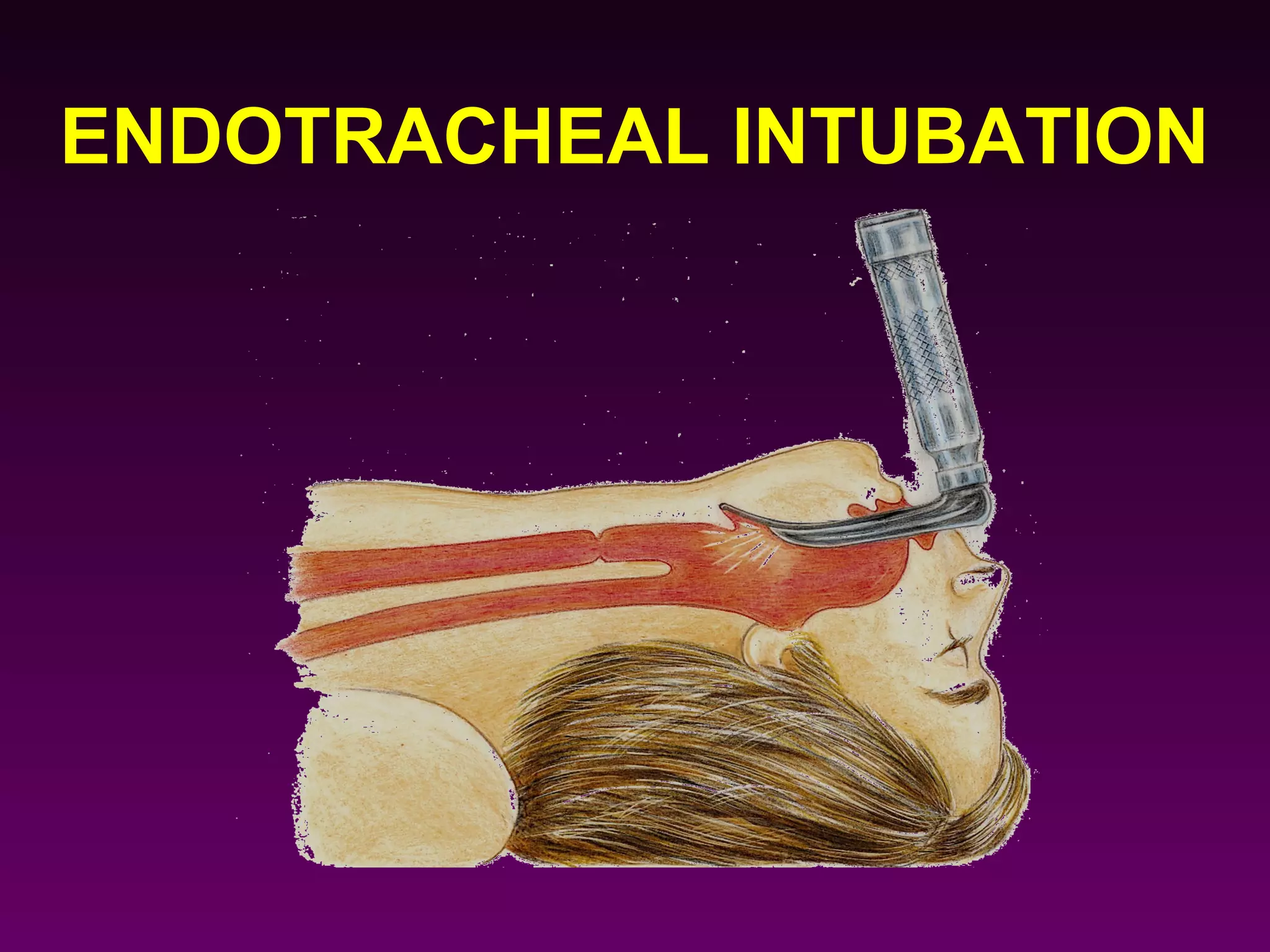 ENDOTRACHEAL INTUBATION
 