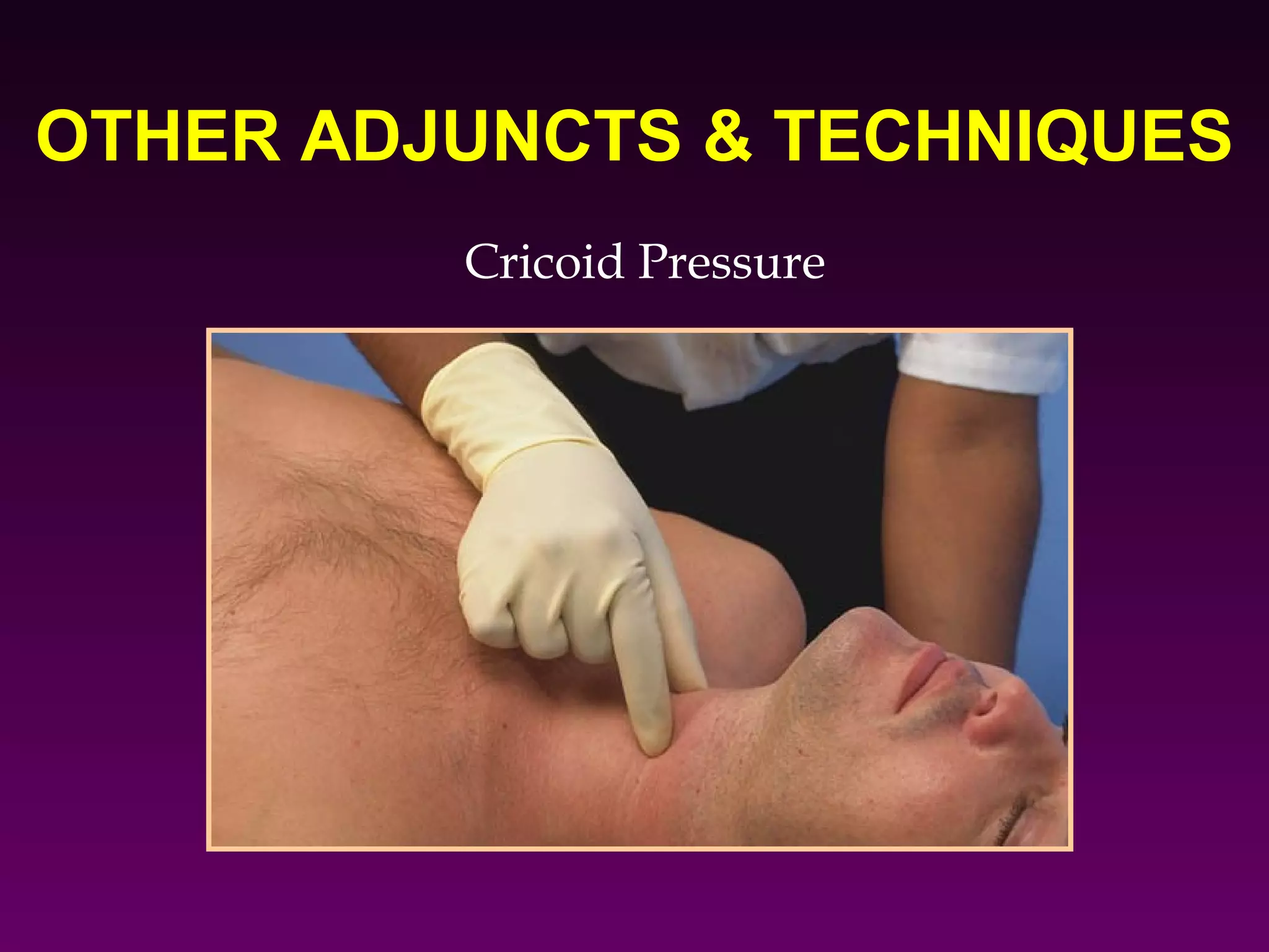 OTHER ADJUNCTS & TECHNIQUES
         Cricoid Pressure
 