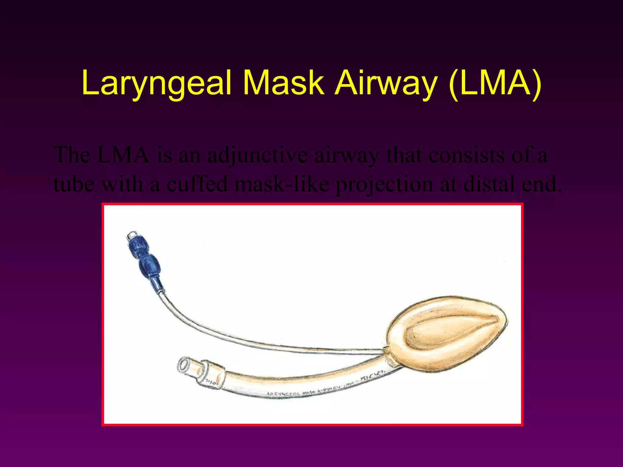 Laryngeal Mask Airway (LMA)
The LMA is an adjunctive airway that consists of a
tube with a cuffed mask-like projection at distal end.
 