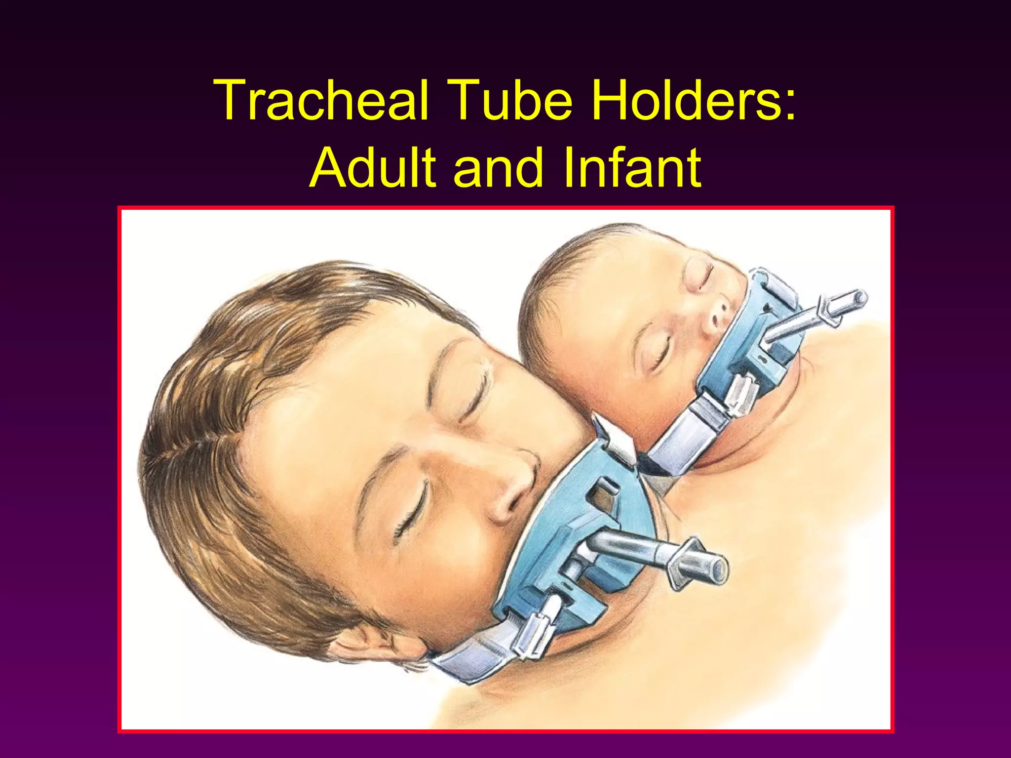 Tracheal Tube Holders:
   Adult and Infant
 