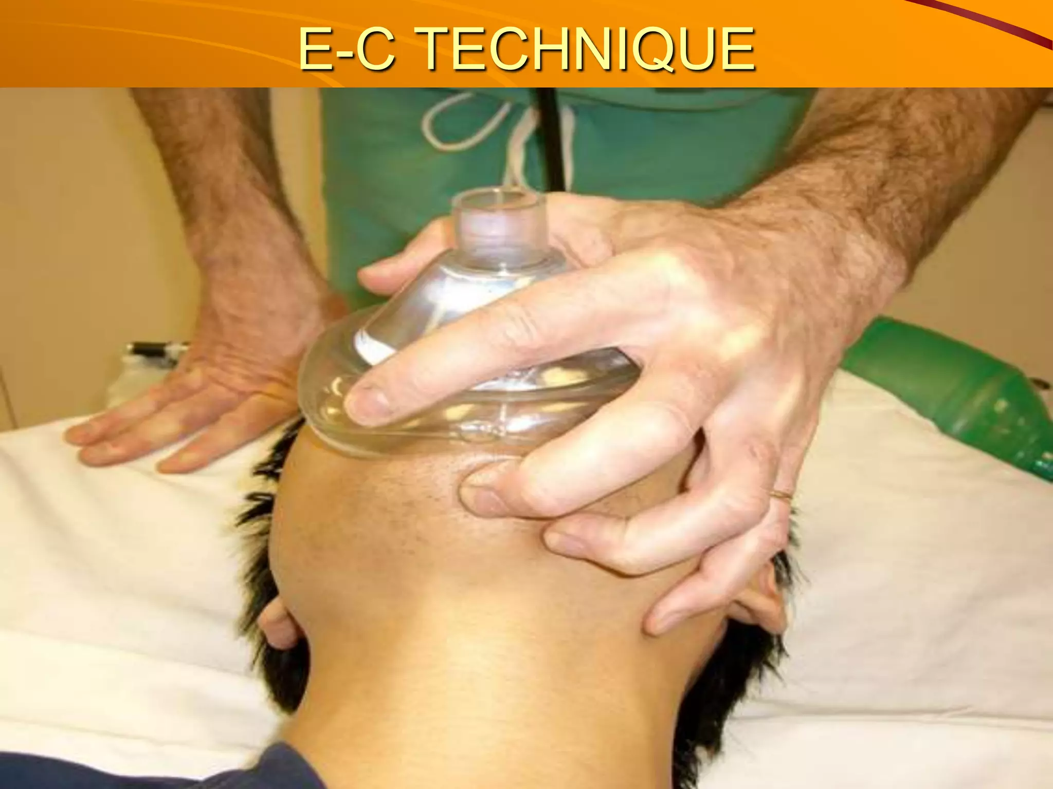 Airway adjuncts & ambu bagging | PPT