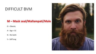 DIFFICULT BVM
M – Mask seal/Mallampati/Male
O – Obesity
A – Age > 55
N – No teeth
S – Stiff lung
 