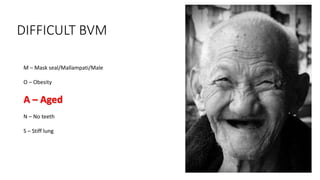 DIFFICULT BVM
M – Mask seal/Mallampati/Male
O – Obesity
A – Aged
N – No teeth
S – Stiff lung
 