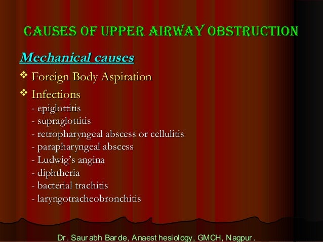 Airway anatomy