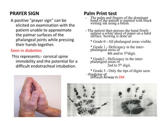 Airway anatomy its assessment and anaesthetic implication | PPTX