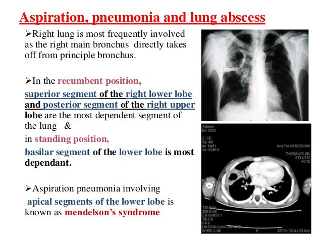 Airway anatomy