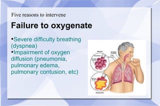 Five reasons to intervene Failure to oxygenate Severe difficulty breathing  (dyspnea) Impairment of oxygen  diffusion (pneumonia,  pulmonary edema,  pulmonary contusion, etc) 