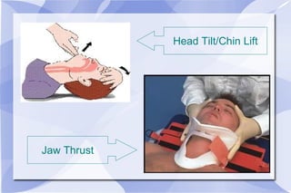 Jaw Thrust Head Tilt/Chin Lift 