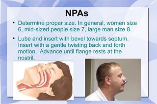 NPAs Determine proper size. In general, women size 6, mid-sized people size 7, large man size 8. Lube and insert with bevel towards septum.  Insert with a gentle twisting back and forth motion.  Advance until flange rests at the nostril. 