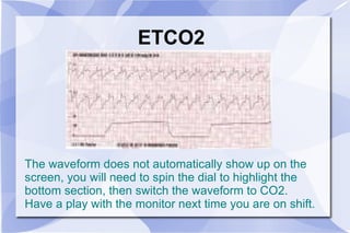 ETCO2 The waveform does not automatically show up on the screen, you will need to spin the dial to highlight the bottom section, then switch the waveform to CO2. Have a play with the monitor next time you are on shift. 