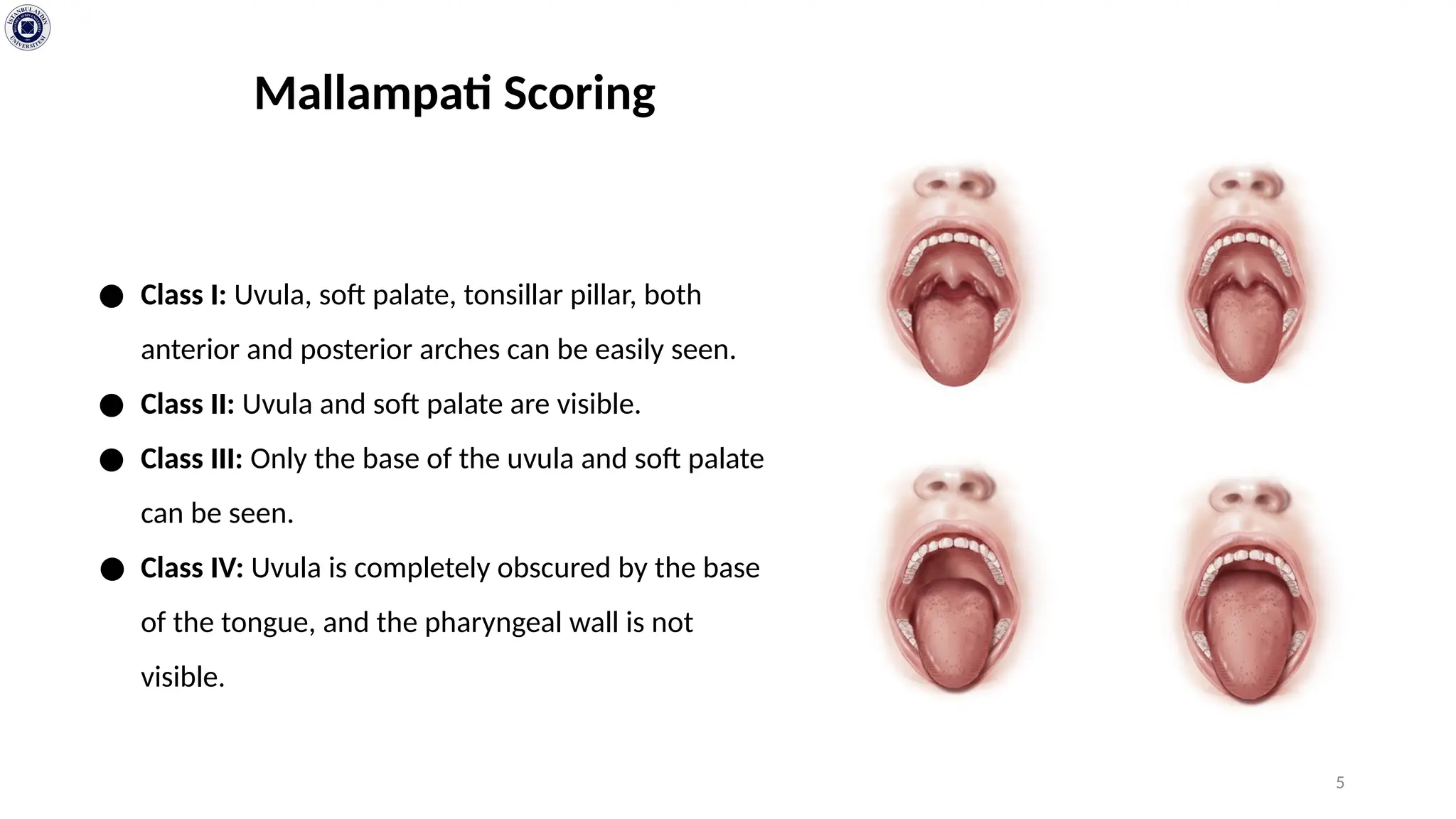 Anesthesia and Reanimation: AIRWAY and ENTUBATION.pptx | Ear, Nose and ...
